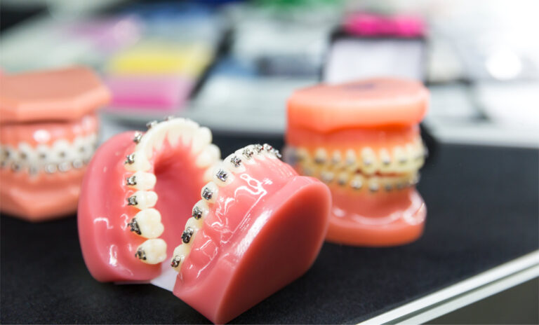 Dental or orthodontic tools, denture closeup